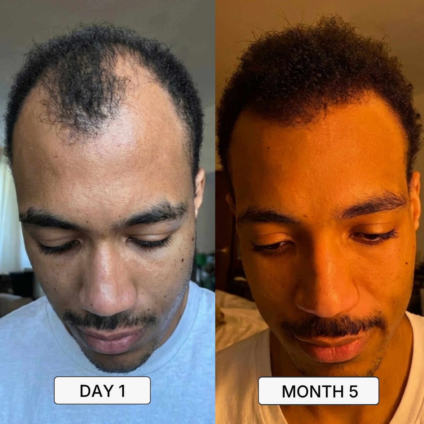 Roven Regrowth System
