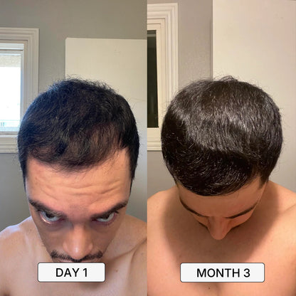 Roven Regrowth System