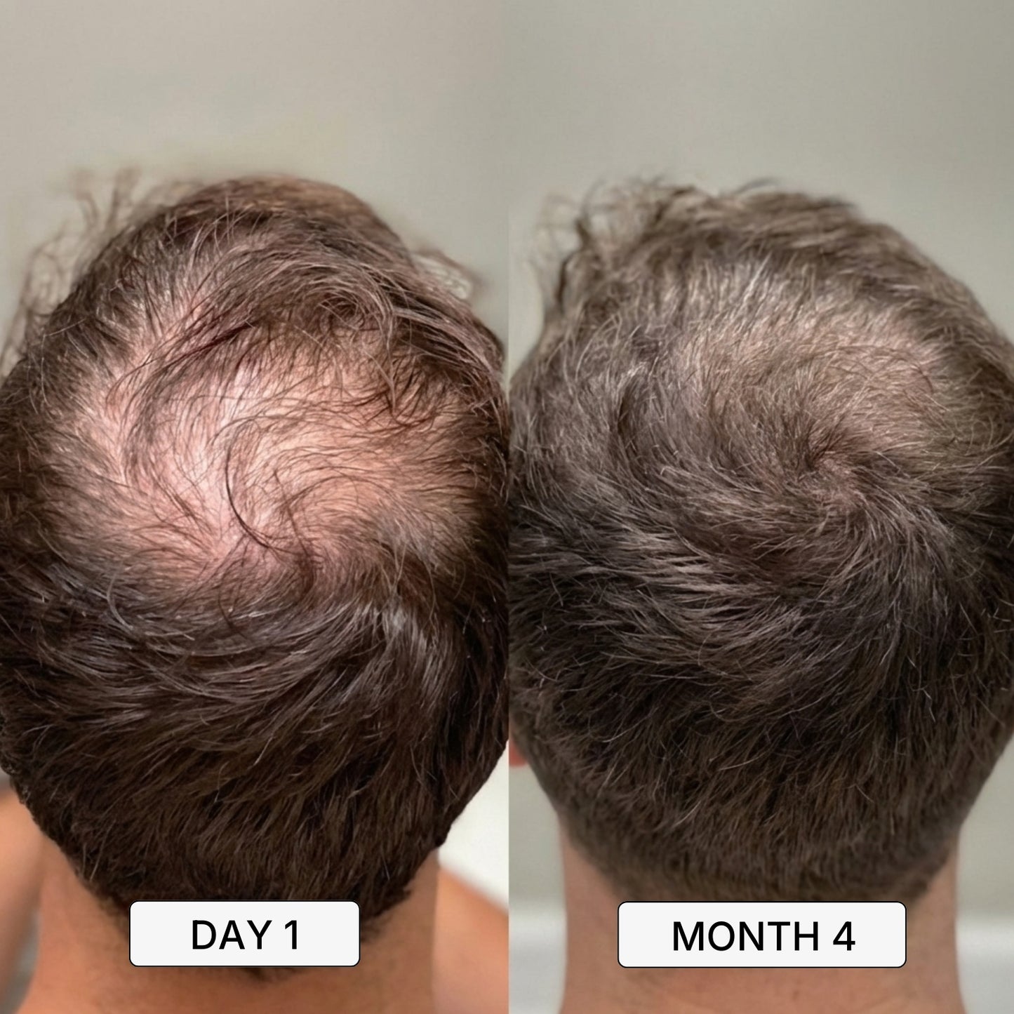 Roven Regrowth System