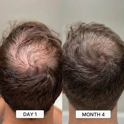 Roven Regrowth System