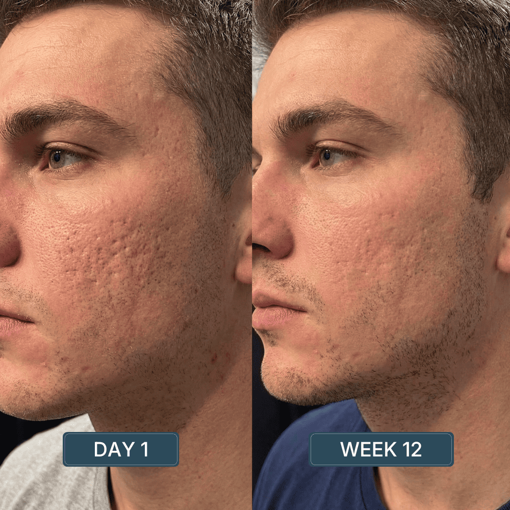Copper Peptide Serum