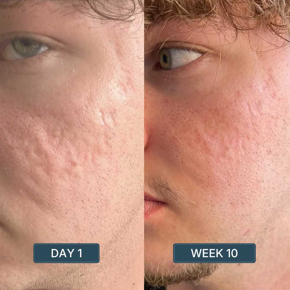 Copper Peptide Serum