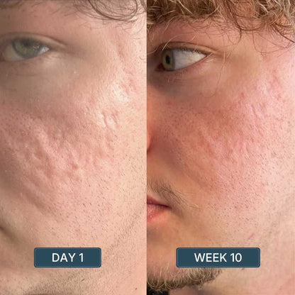 Copper Peptide Serum