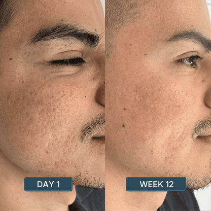 Copper Peptide Serum