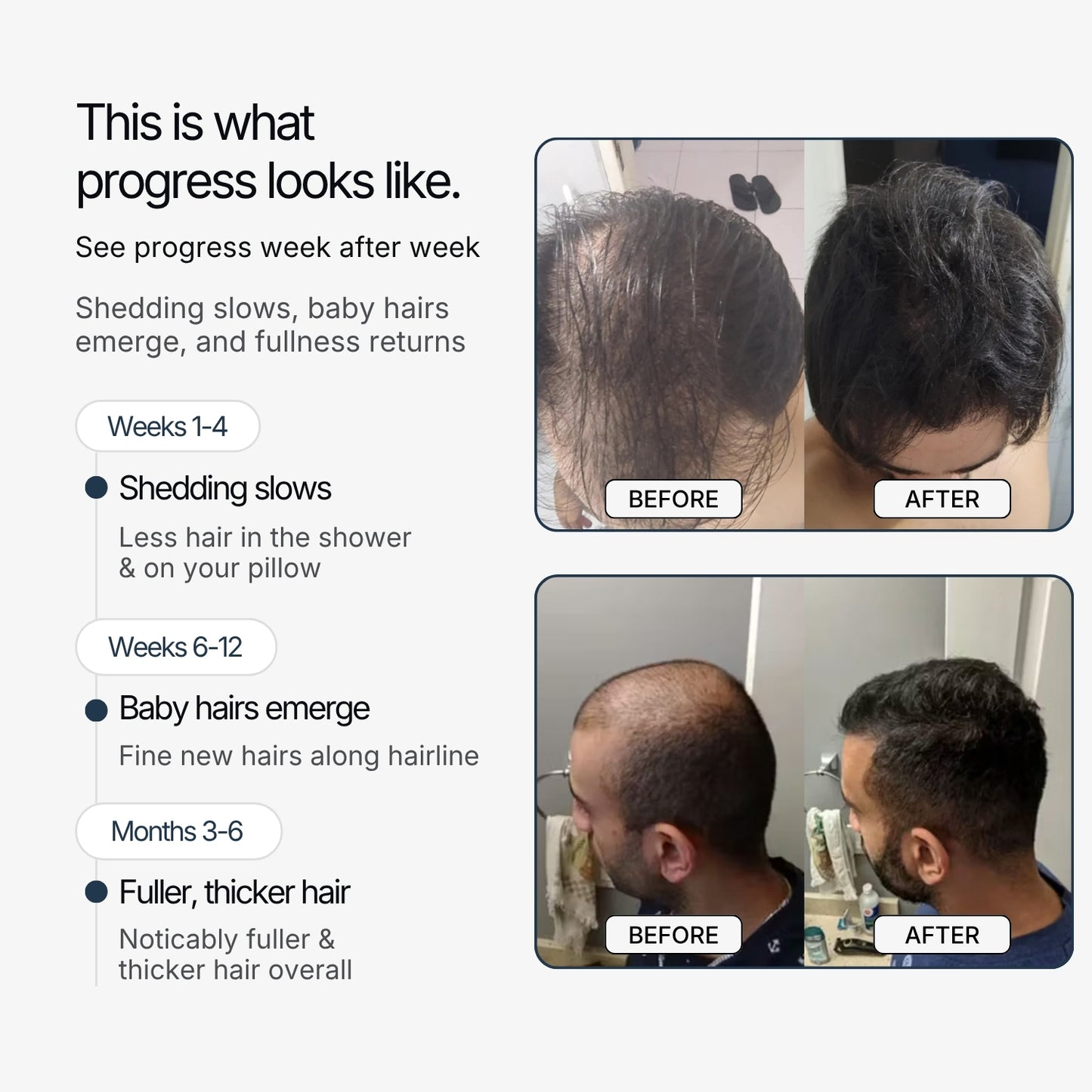Roven Regrowth System